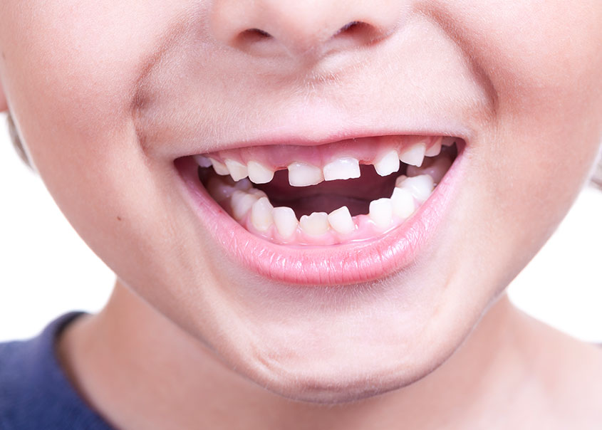 Children's Dentistry | Mirage Dental | General and Family Dentist | SE Calgary