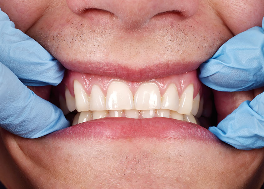 Dental Hygiene | Mirage Dental | General and Family Dentist | SE Calgary