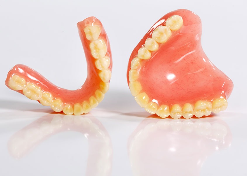 Dentures | Mirage Dental | General and Family Dentist | SE Calgary