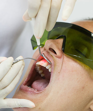 Laser Therapy | Mirage Dental | General and Family Dentist | SE Calgary