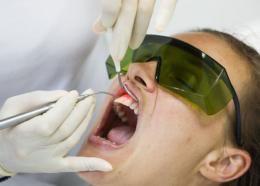 Calgary Laser Therapy | Mirage Dental | General and Family Dentist | SE Calgary