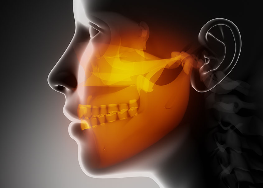 TMJ/TMD Therapy | Mirage Dental | General and Family Dentist | SE Calgary