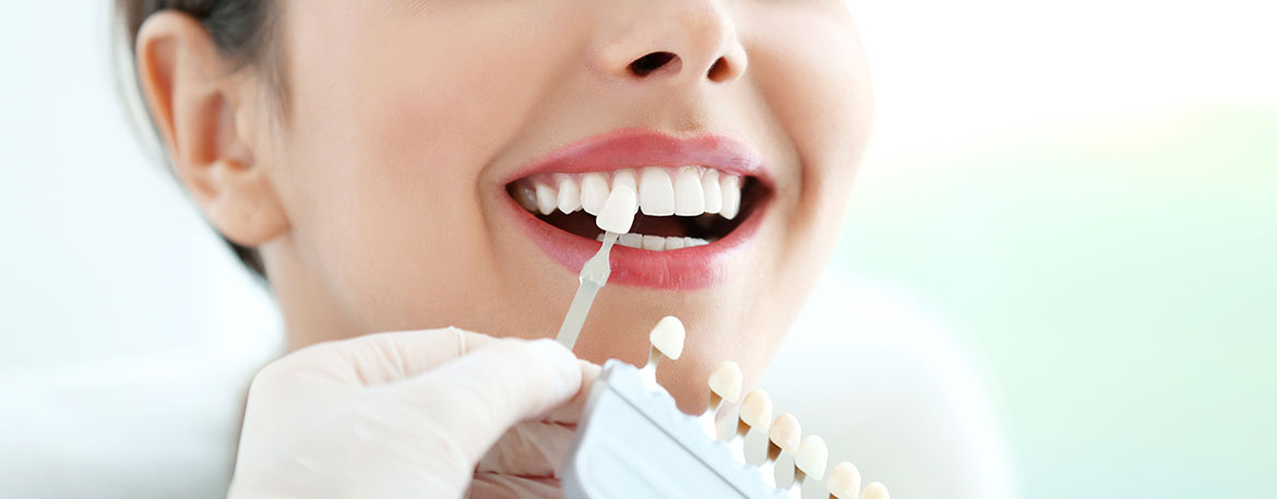Porcelain Veneers Calgary | Mirage Dental | General and Family Dentist | SE Calgary