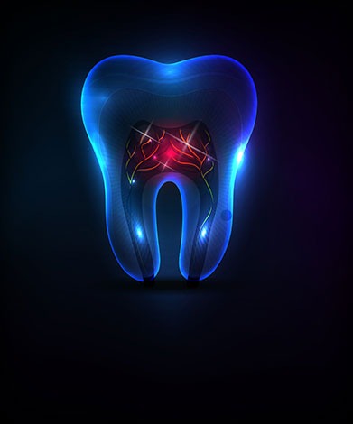 Calgary Root Canal Therapy | Mirage Dental | General and Family Dentist | SE Calgary